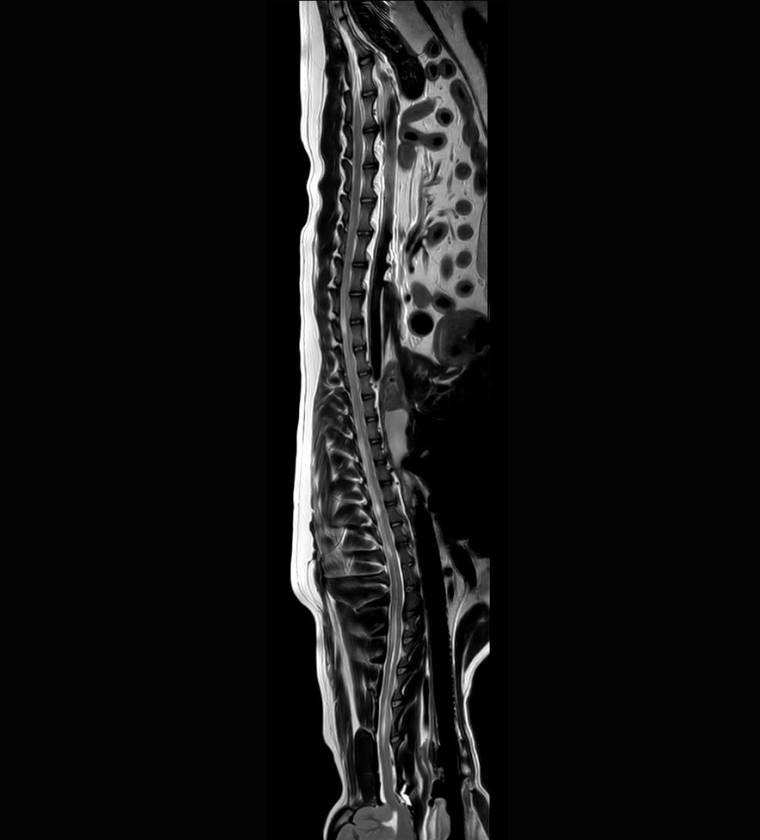 MRI of an animal by the veterinary neurology department of the Vétélys clinic in Geneva