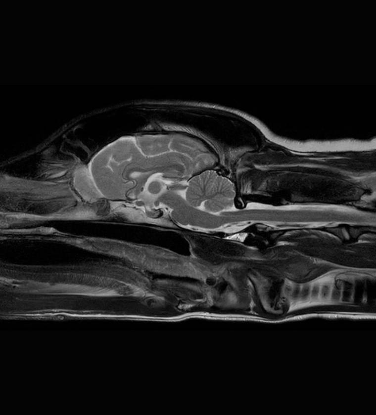 MRI in the neurology department of the Vétélys clinic in Geneva